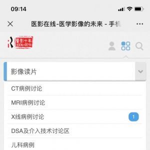 醫(yī)療公眾號開發(fā)_【醫(yī)影在線】公眾號的認證時間